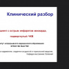 Вебинар РКО «Острый коронарный синдром - 2020»