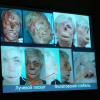 2012-12-12 - II Национальный конгресс по пластической хирургии