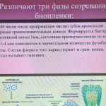 На кафедре терапевтической стоматологии состоялось заключительное в 2020 году заседание молодежного научного общества