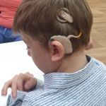 Ученые ВолгГМУ научат глухих детей слышать